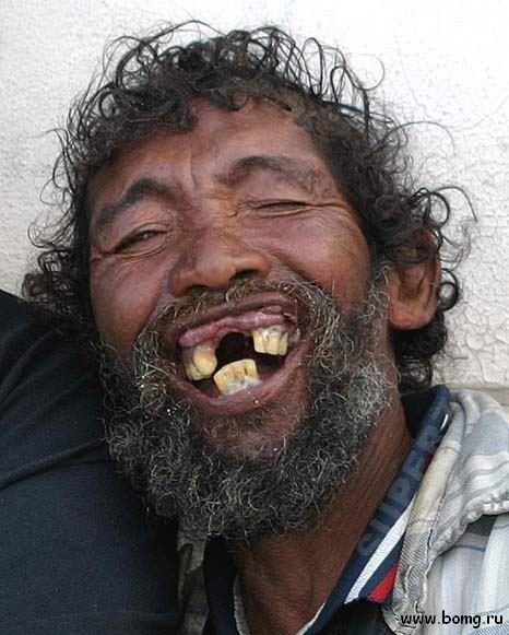 teeth.jpg